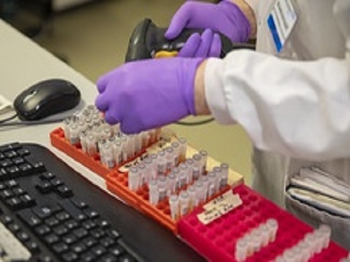 CORONAVIRUS TESTS BECAME scarce when more and more people in the United States began to get sick. More tests and more rapid results are now available for those who are most compromised.
